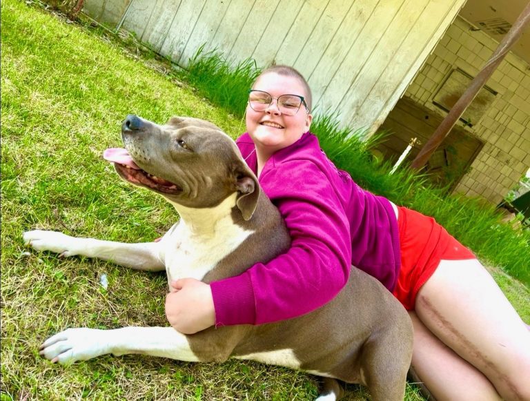 Madelyn laying on the grass with her dog with a visible scar down her leg